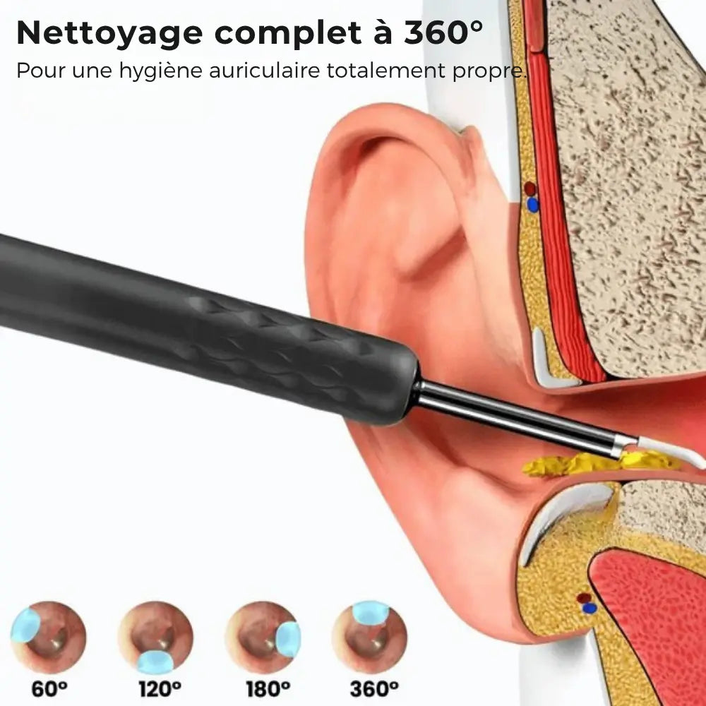 CleanEar Pro™ | Hygiène auriculaire High tech avec vision totale