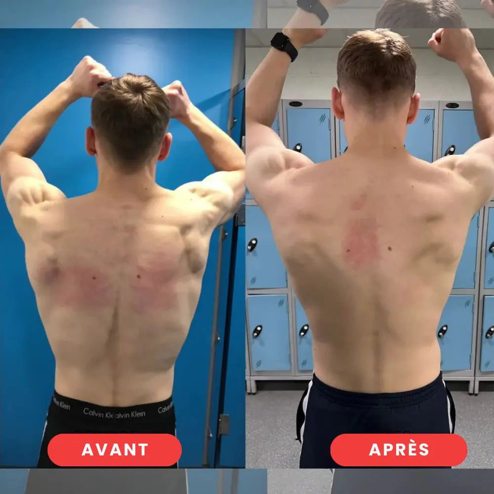 AlignFlex™ | Le correcteur pour une posture parfaite